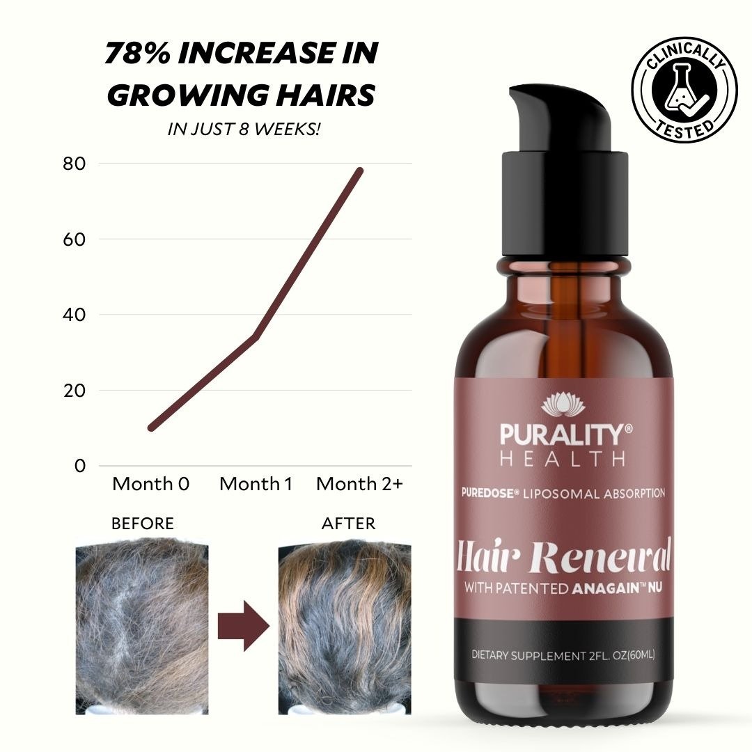 Purality Health Hair Renewal Review showing increase in growing hairs